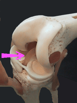 ligament croisé antérieur et les autres ligaments